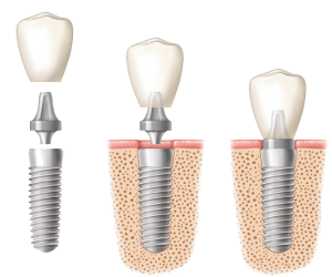 dentist land o lakes